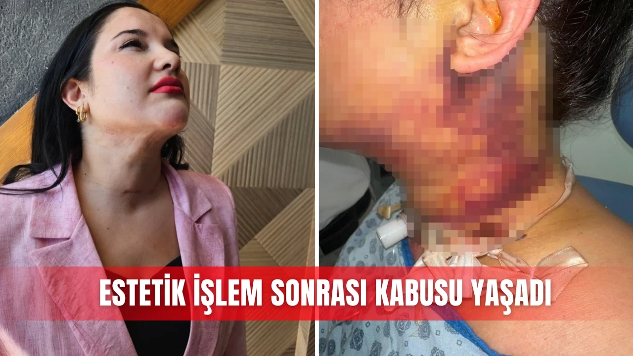 Estetik İşlem Sonrası Kabusu Yaşadı - Antalya Haber